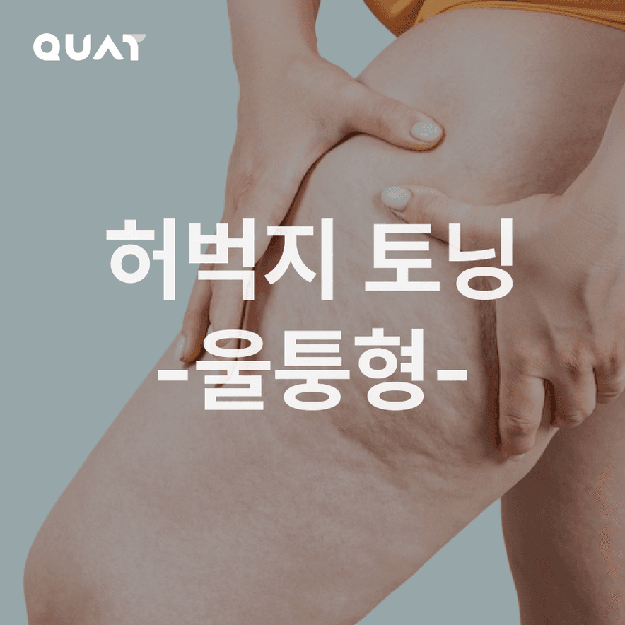 허벅지 싹둑 트레이닝-울퉁형-